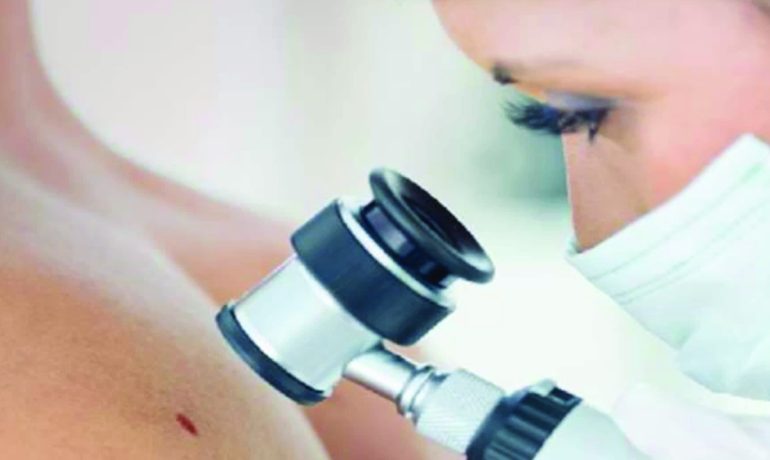 Wie verbessern wir die Betreuung unserer Hautkrebspatienten