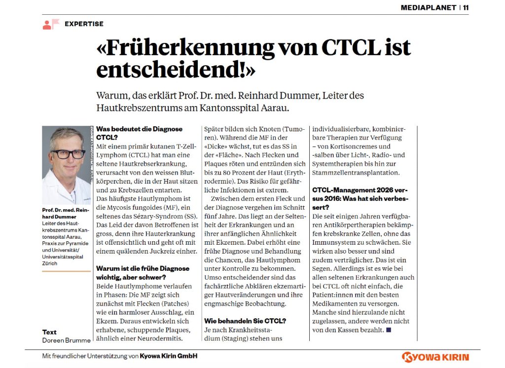 Früherkennung von CTCL ist entscheidend